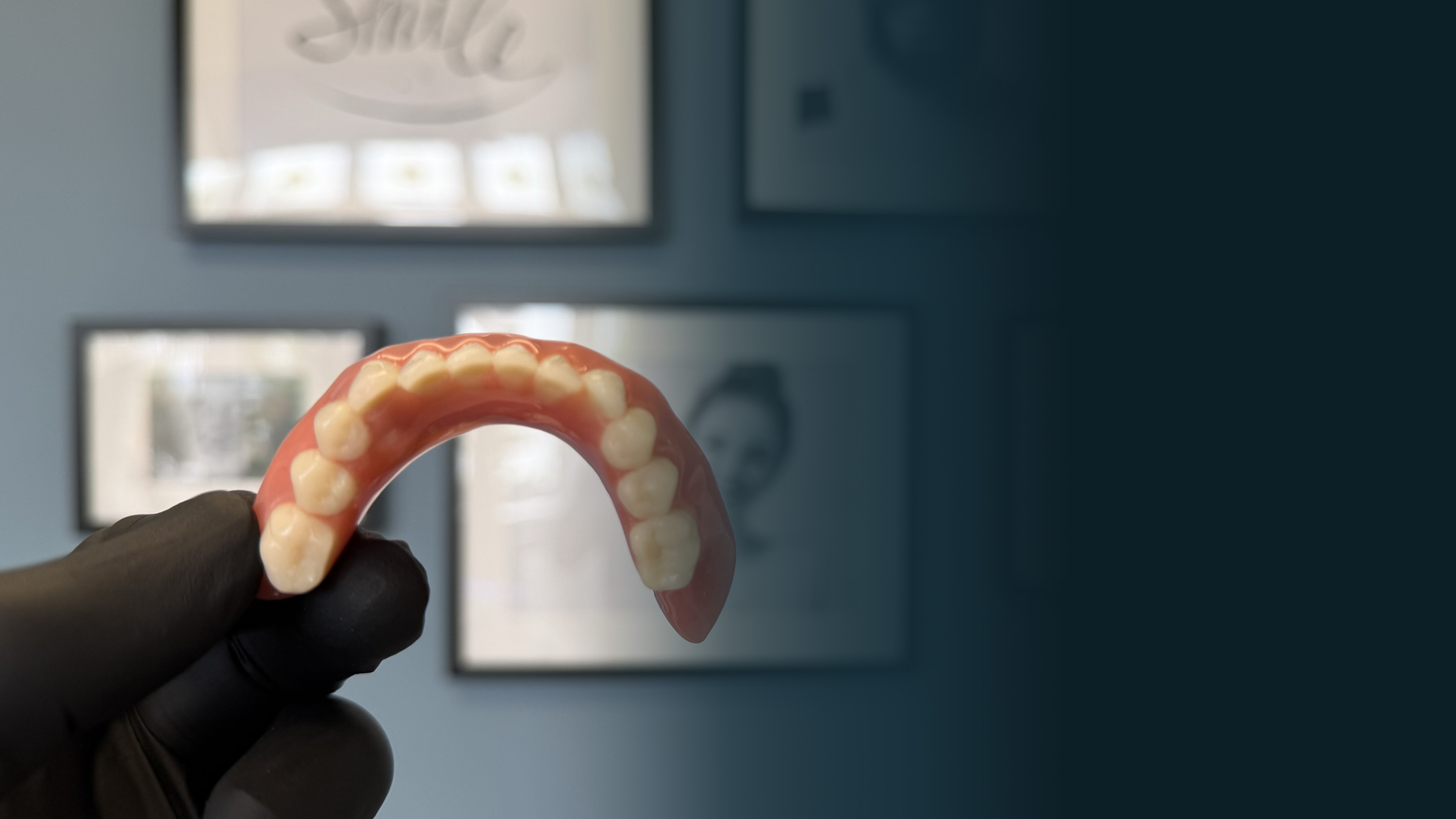 Custom-made denture at Bespoke Dental, Malahide