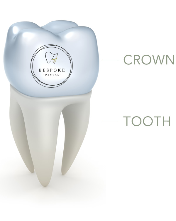 Diagram showing the parts of a dental crown
