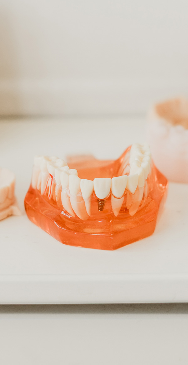 Dr Daniel Hargitai answering a patient’s questions about dental implants