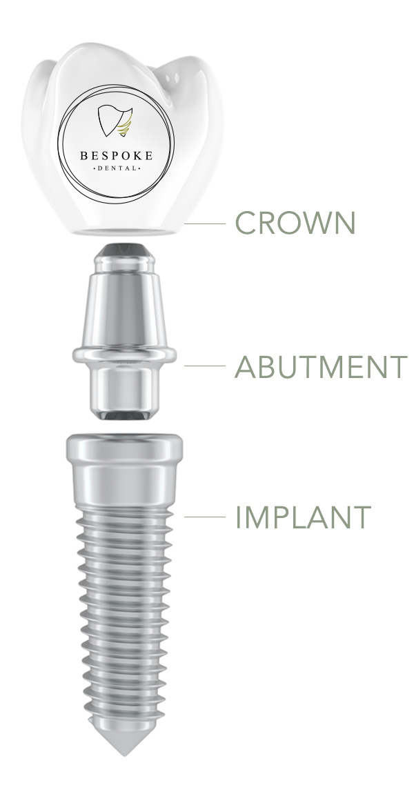BESPOKE DENTAL, MALAHIDE