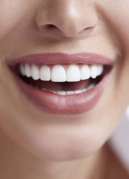 Close-up of a bright, even smile after cosmetic dental treatment