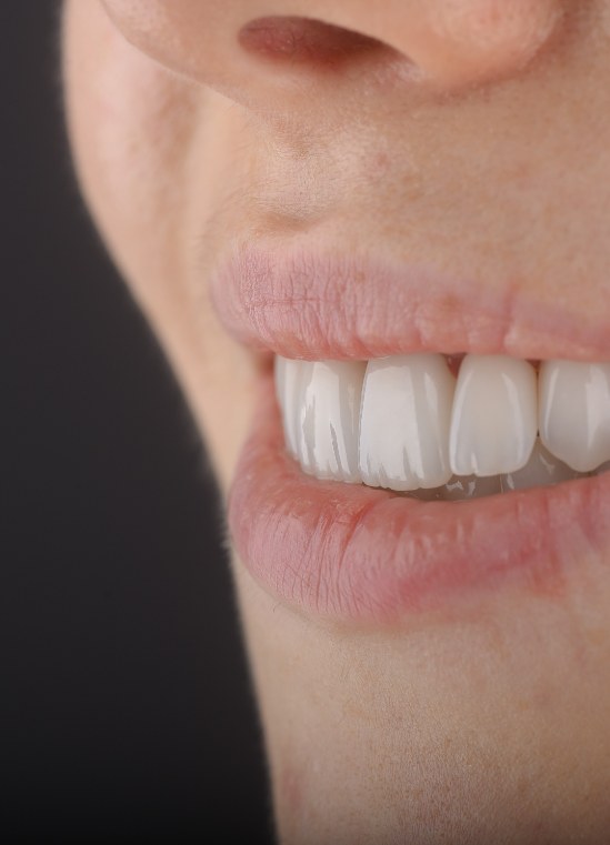 Close-up of a natural-looking smile after cosmetic dental treatment